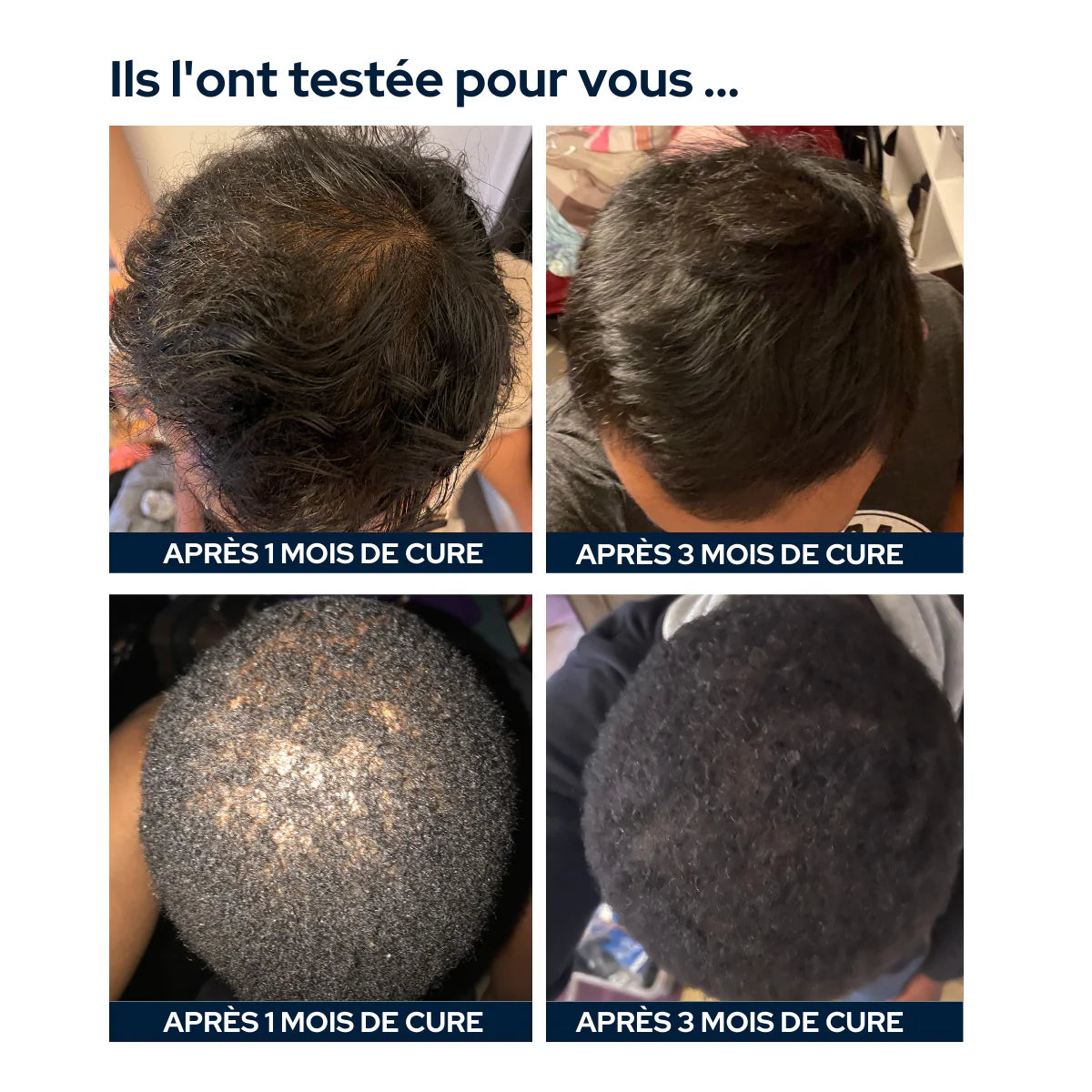 Cure Complexe Chute de Cheveux Hommes Epycure - Bewell