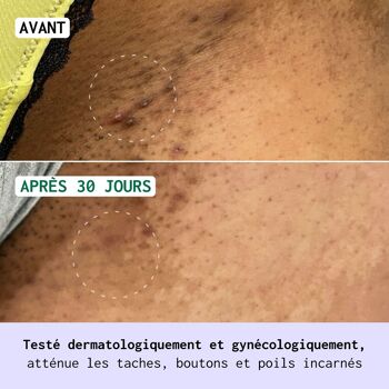 Melintim Crème Multi-Réconfortante Zones Intimes Externes 75 mL - Bewell