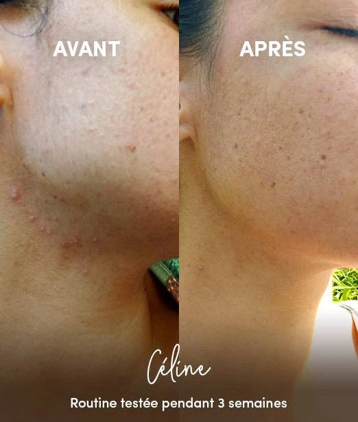 Masque Visage Purifiant en Poudre BIO 50g - Bewell