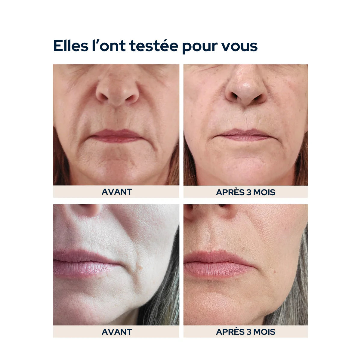 Reculpated skin cure Epycure