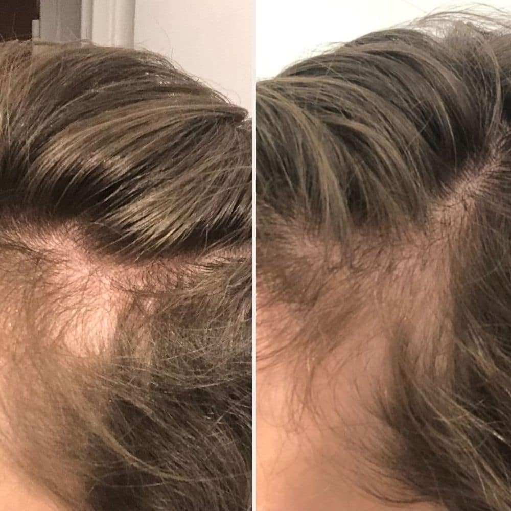 [MY] Sérum Cheveux Densifiant Anti-Chute