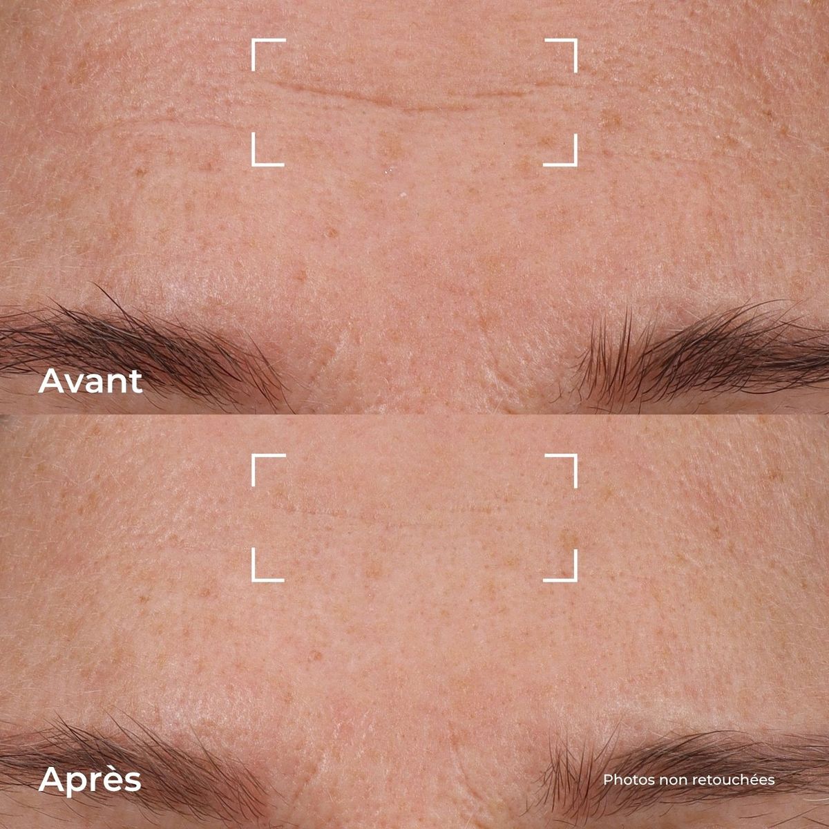 Crème Repulpante Fermeté – 40 ml